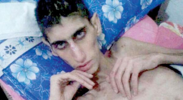   به‌ وێنه‌.. منداڵانی مه‌زایا له‌ برسان ده‌مرن